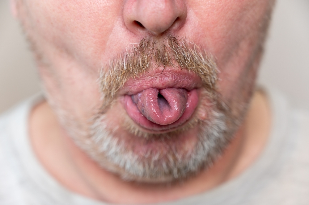 Tongue twisters